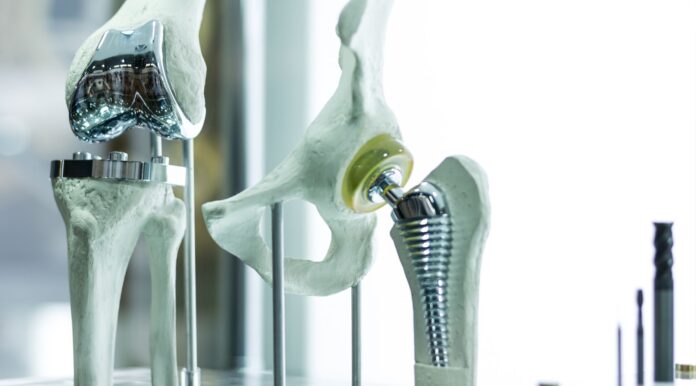 No momento, você está visualizando Preços de órteses, próteses e materiais especiais têm queda de 0,32% em janeiro